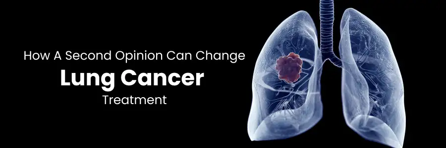 Second Opinion Impact on Lung Cancer
