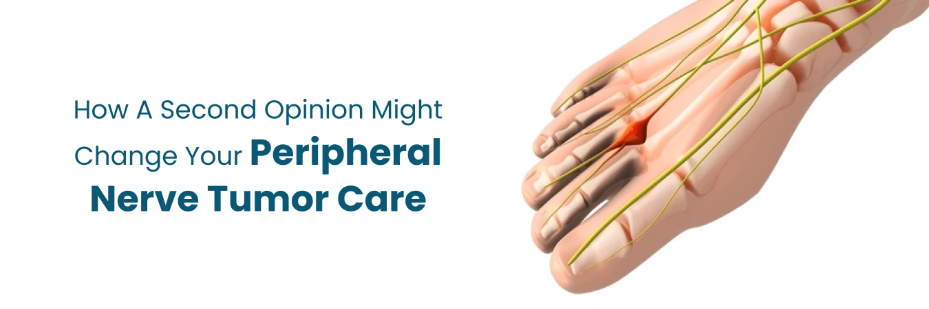Second Opinion: A Game-Changer in Peripheral Nerve Tumor Care