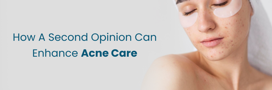How second opinion enhances acne treatment outcomes