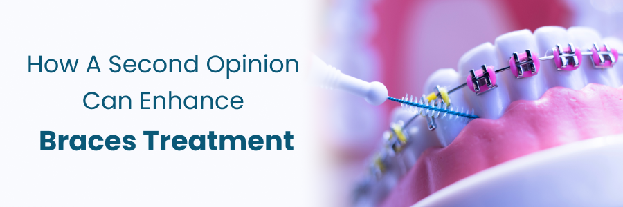 How a second opinion improves braces treatment outcomes