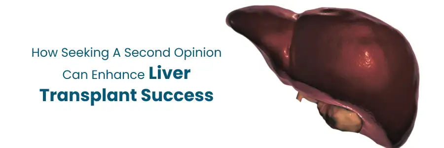 How a second opinion improves liver transplant care outcomes