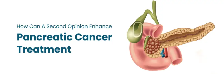 Second Opinion Enhance Pancreatic Cancer Treatment