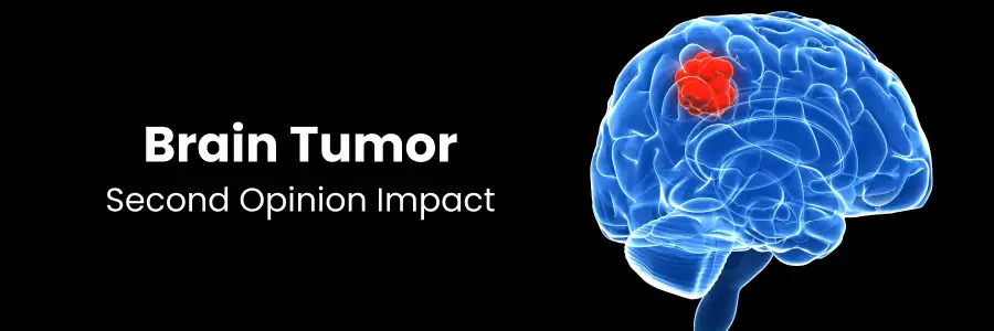 Brain Tumour Second Opinion Impact