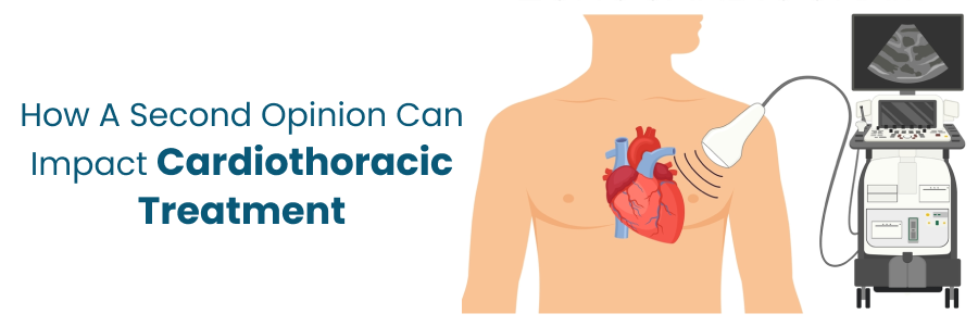 Second Opinion's Impact on Cardiothoracic Treatment