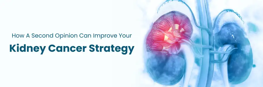 Improve Your Kidney Cancer Strategy with a Second Opinion