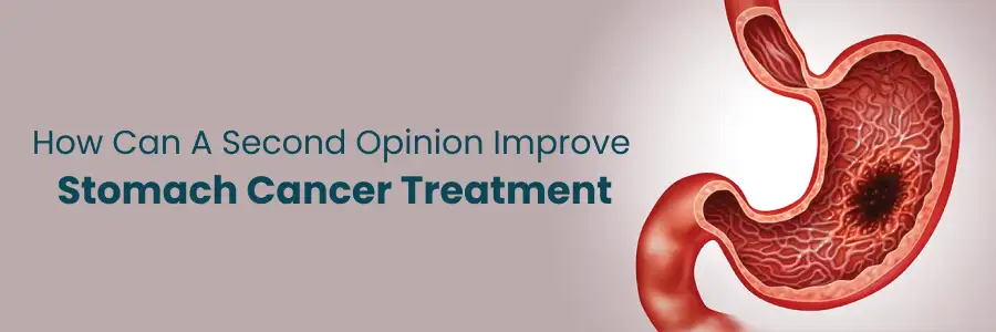 How a Second Opinion Can Improve Stomach Cancer Treatment
