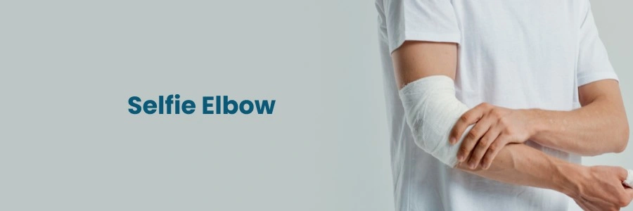 Selfie Elbow: Causes, Prevention, and Treatment