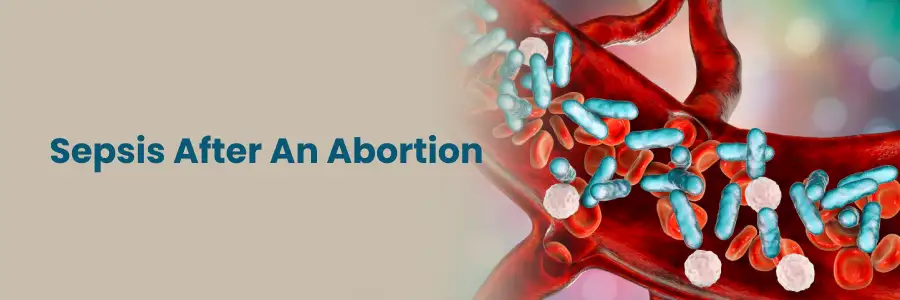 Sepsis After Abortion: Symptoms & Treatment