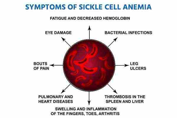 sickle cell day
