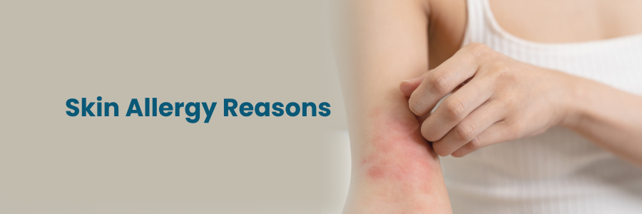 Skin Allergy Reasons