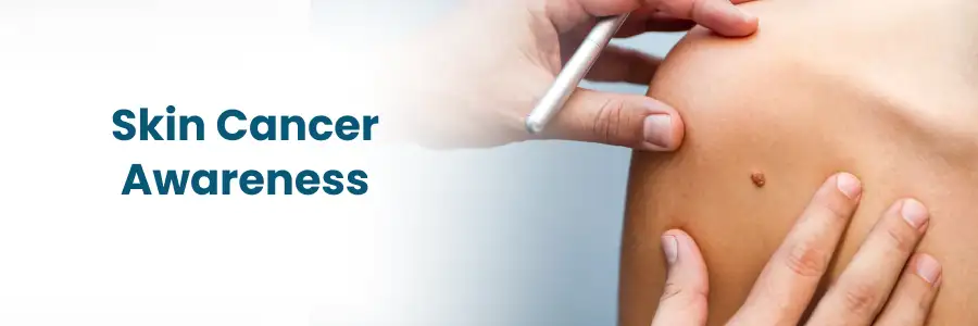 Skin cancer awarness