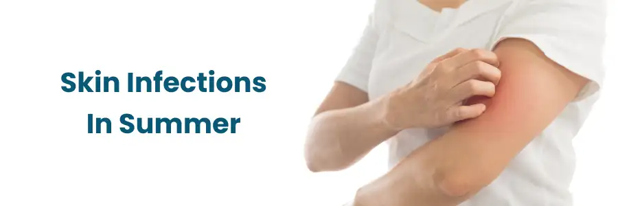 Summer Skin Infections: Fungal, Bacterial & Viral Causes