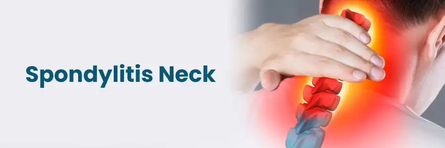 Spondylitis Neck