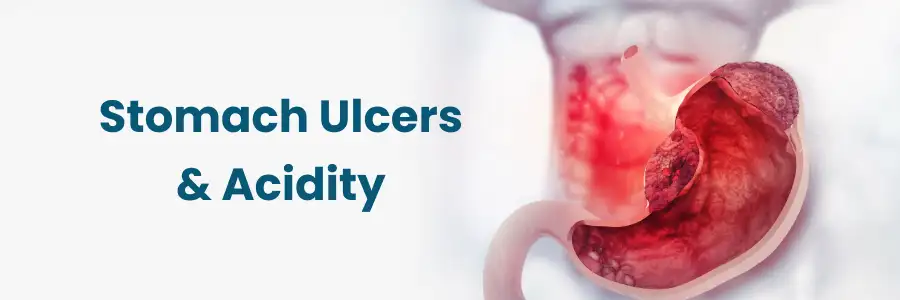 Summer Aggravates Stomach Ulcers & Acidity