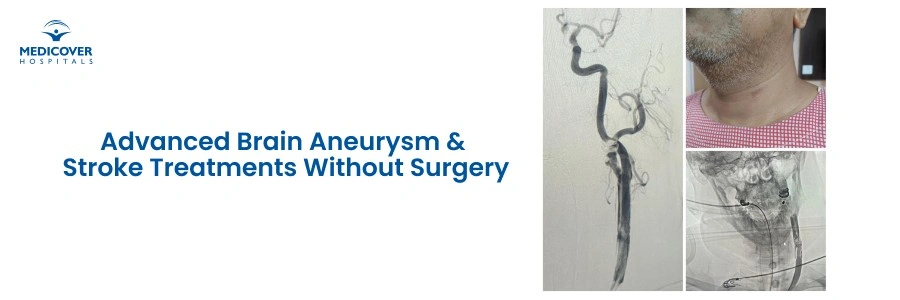 Advanced Brain Aneurysm & Stroke Treatment Without Surgery | Dr Anirudh Rao Deshmukh