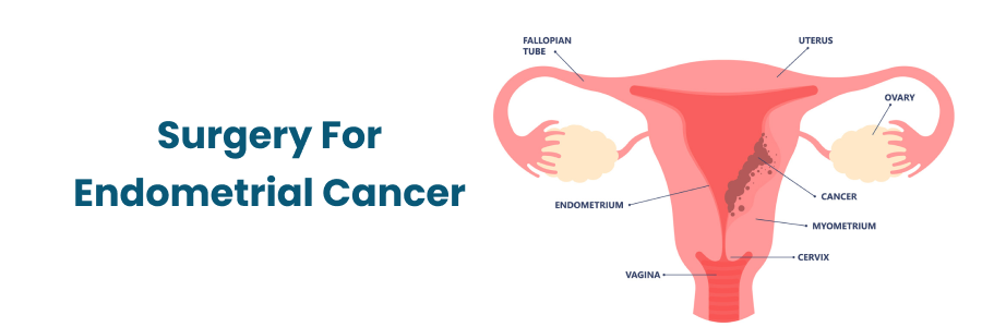 Surgery for Ectopic Pregnancy