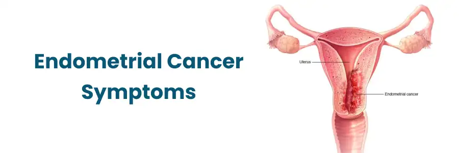 Symptoms of Endometrial Cancer in Vizag