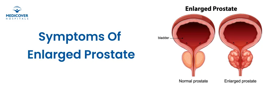 Symptoms of Enlarged Prostate You Should Not Ignore
