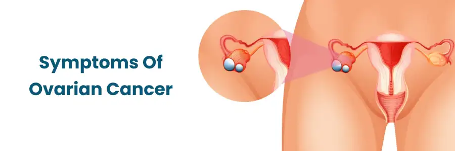 Symptoms Of Ovarian Cancer