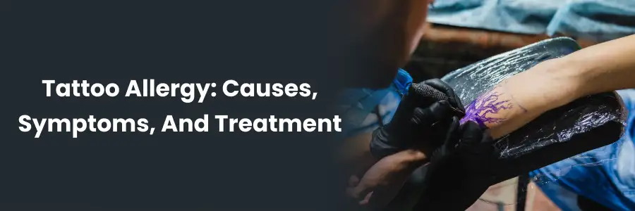 Tattoo Allergy: Symptoms & Treatment