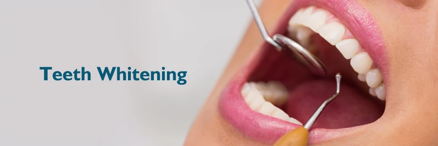 Teeth Whitening