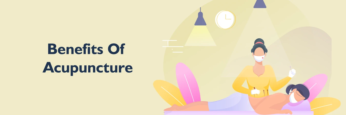 The Benefits of Acupuncture