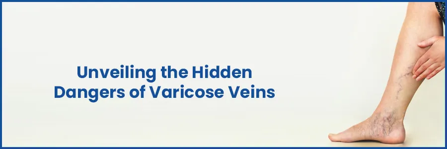 The Hidden Dangers of Varicose Veins