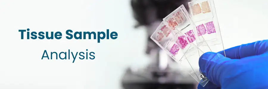 Tissue Sample Analysis Begumpet
