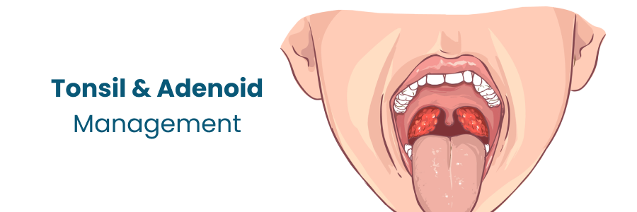 Tonsil and Adenoid Management Begumpet
