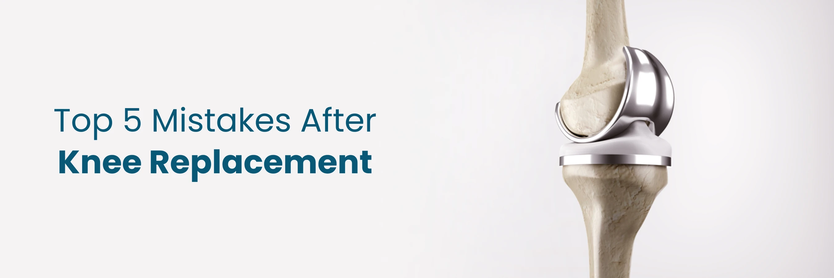 top 5 mistakes after knee replacement
