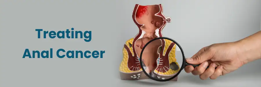 Treating Anal Cancer in Hyderabad