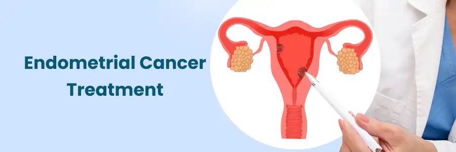 Treatment for Endometrial Cancer in Hyderabad