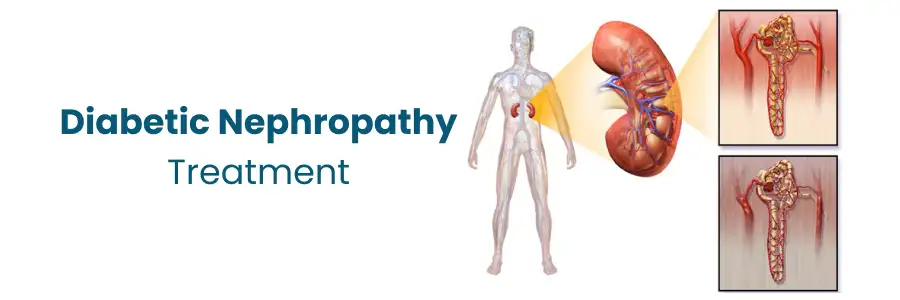 Treatment Options for Diabetic Nephropathy

