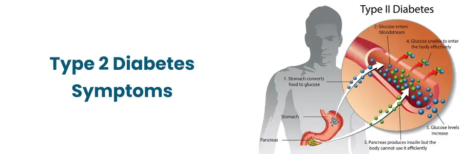 Type 2 Diabetes Symptoms