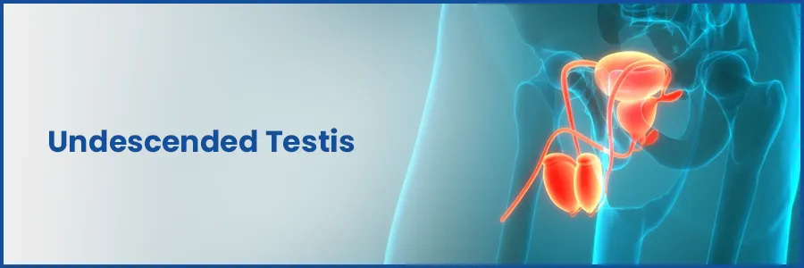 Undescended Testis: Causes, Symptoms & Treatment | Medicover Hospital