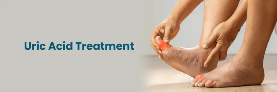Uric Acid Treatment