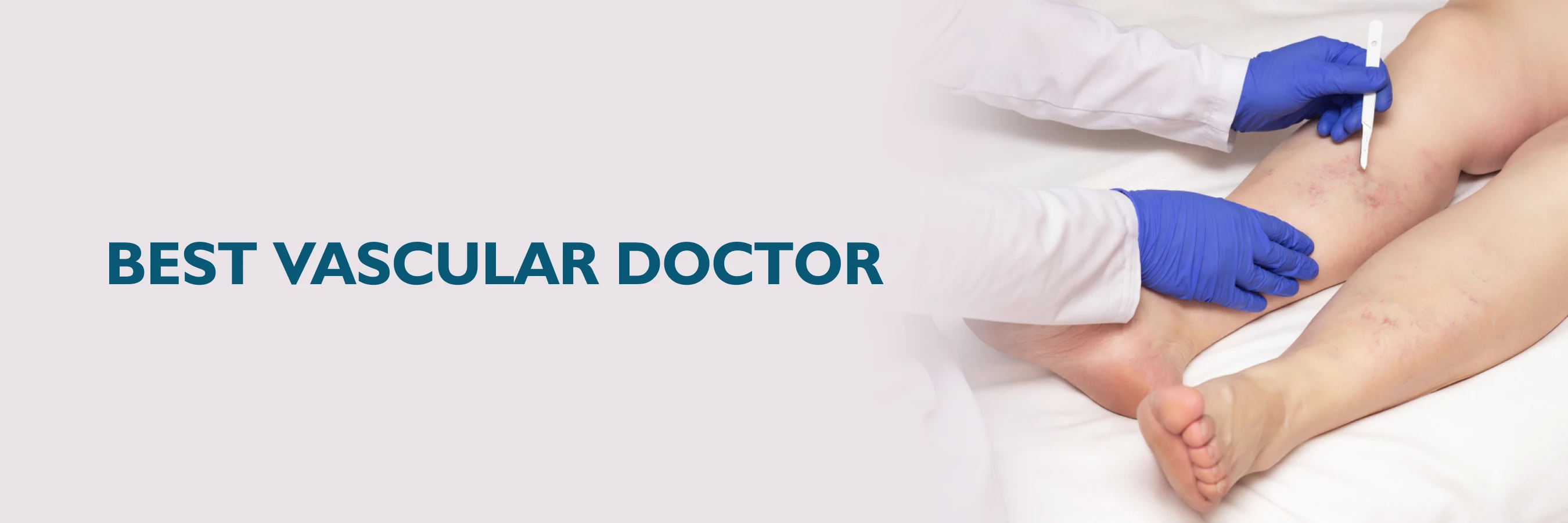 Finding the Best Vascular Doctor