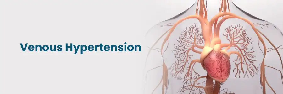 Venous Hypertension: Symptoms & Treatment