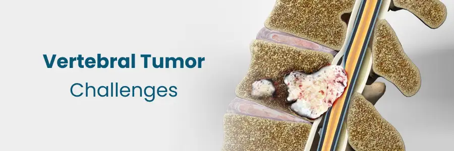 Vertebral Tumor Treatment at Medicover Hospitals Vizag