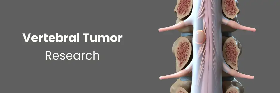 Vertebral Tumor Research in Hyderabad