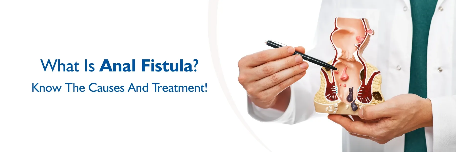 What is Anal Fistula Causes, Symptoms and Treatment
