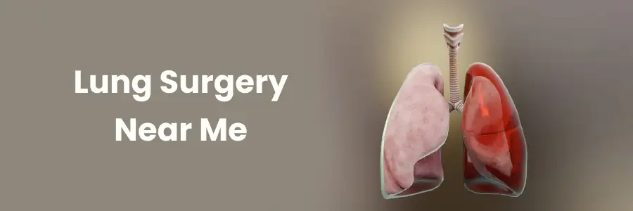 What to Expect from Lung Surgery Near You Bangalore