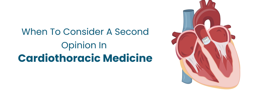 When to Consider a Second Opinion in Cardiothoracic Medicine