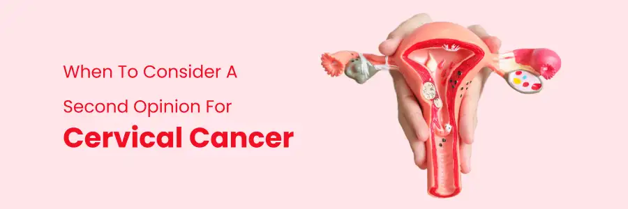 When to Consider a Second Opinion for Cervical Cancer