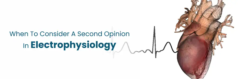 Right Time To Consider Electrophysiology Second Opinion