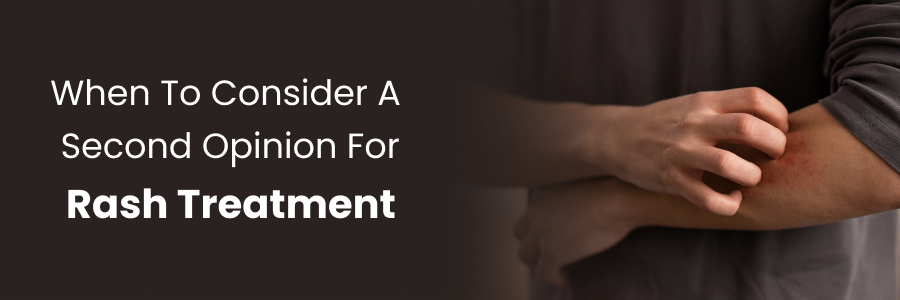 When to seek a second opinion for rash treatment decisions