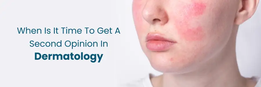 When to Get a Second Opinion in Dermatology