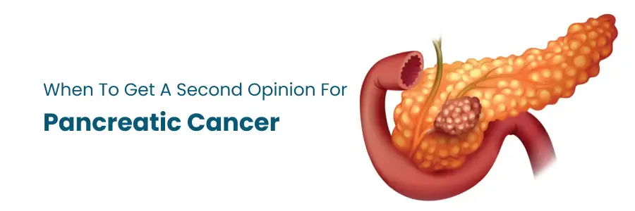 When to Get Second Opinion for Pancreatic Cancer