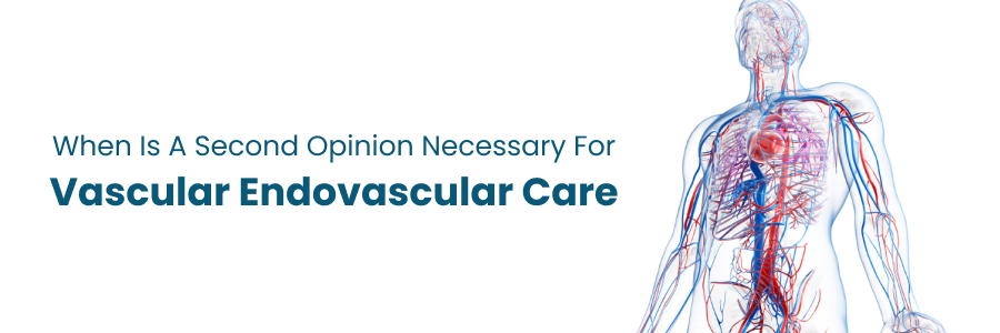 Second opinion necessity in endovascular care
