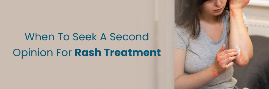 When to get a second opinion for rash treatment decisions